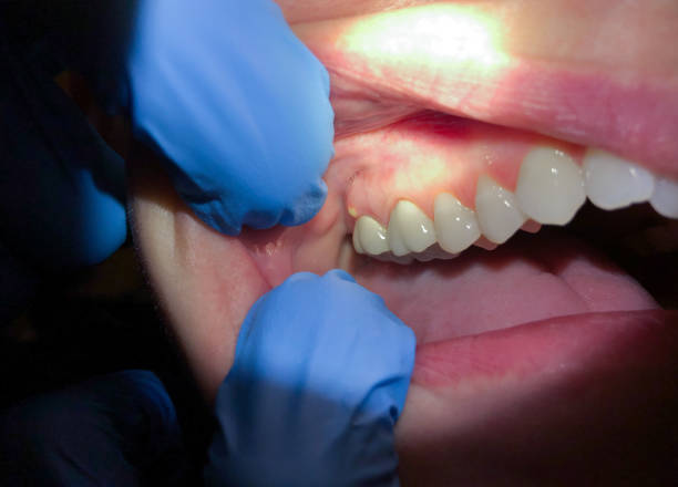 Best Emergency Gum Pain Relief  in Farmington, MO