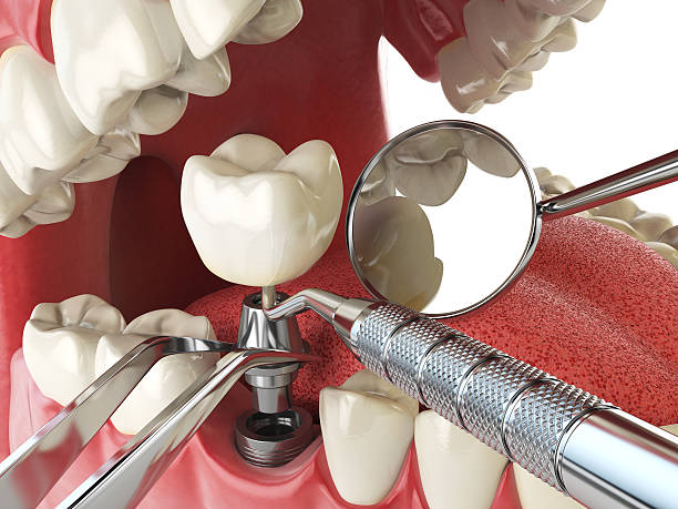 Best Urgent Tooth Repair  in Farmington, MO